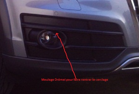 687245cerclageQ52.jpg